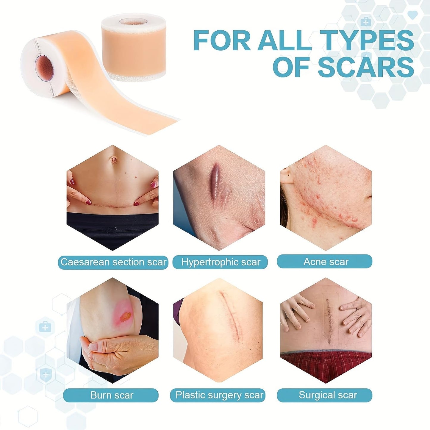Carlié Silicone Scar Tape